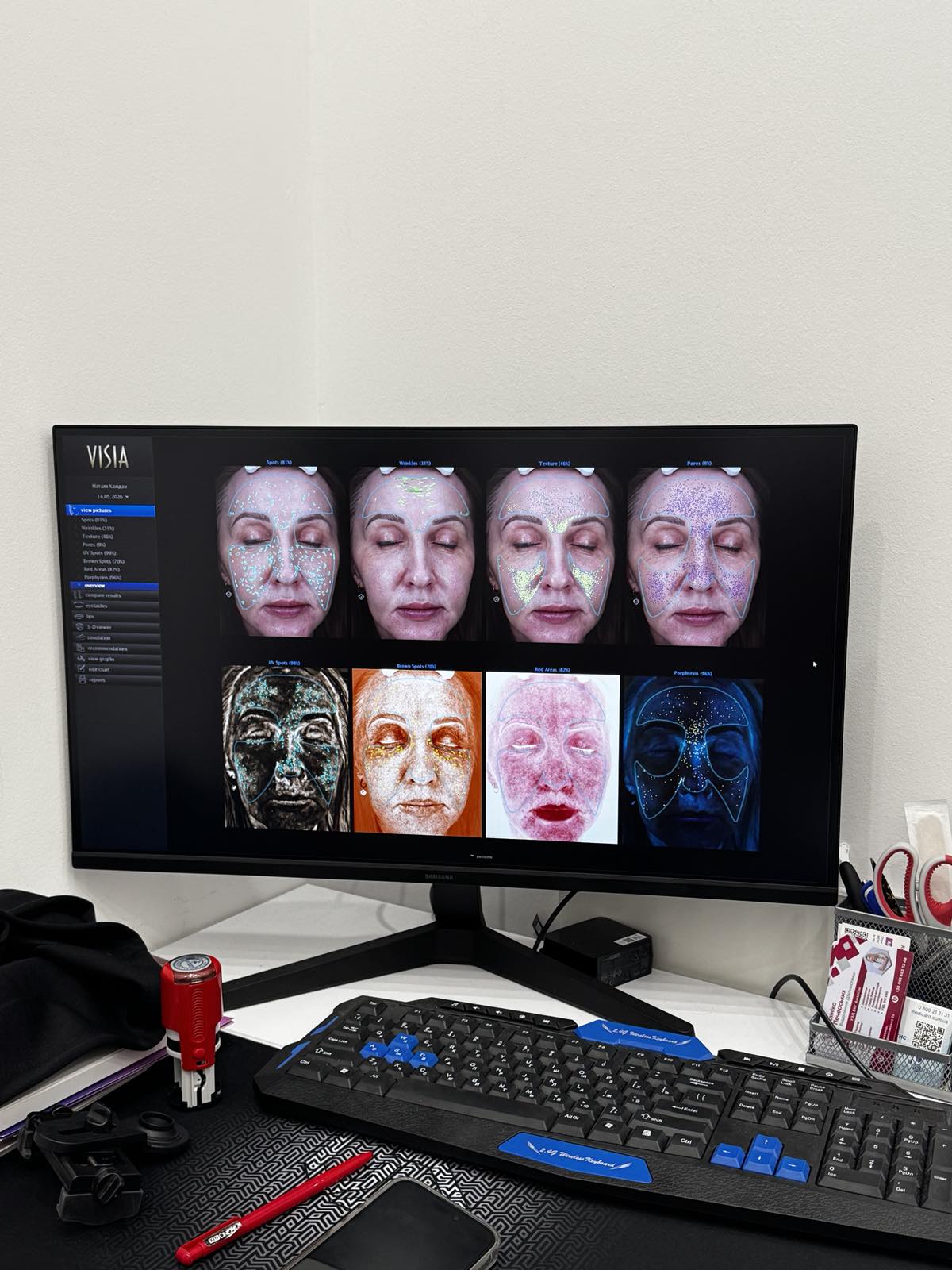 Hardware diagnostics of facial skin in Truskavets