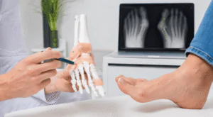 Hallux Valgus (кісточка на стопі): сучасні методи лікування